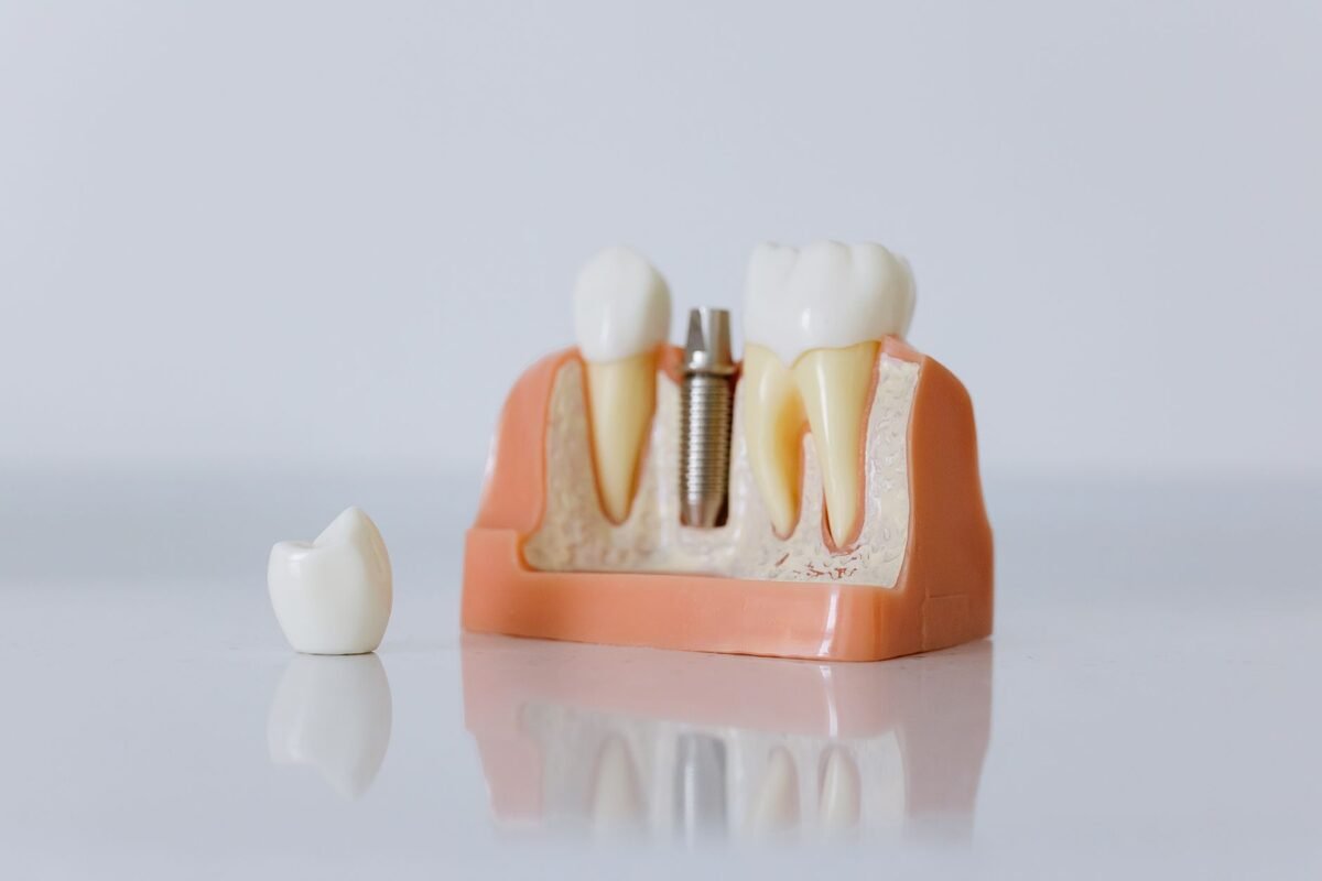 Dentist showing a patient a single tooth implant model with the post, abutment, and crown